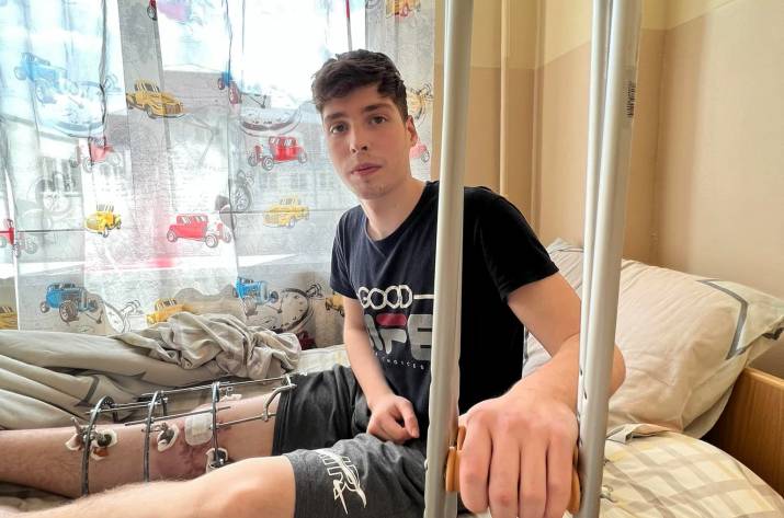 17-річному волонтеру із Сєвєродонецька рятують ногу більше двох місяців