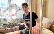 17-річному волонтеру із Сєвєродонецька рятують ногу більше двох місяців