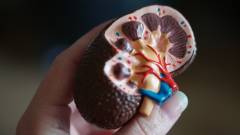 нирки сечовидільна система