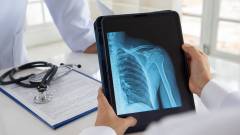 Цифровой рентген