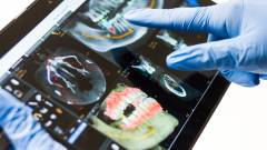 применение интраоральных сканеров в стоматологии