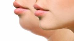 второй подбородок