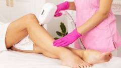 лазерна епіляція